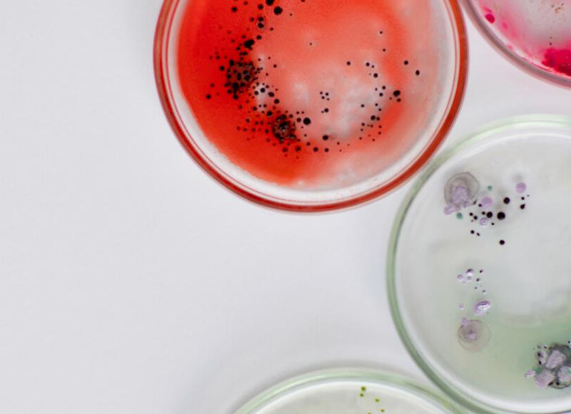 Nahaufnahme Petrischalen mit unterschiedlich gefärbten Kulturen