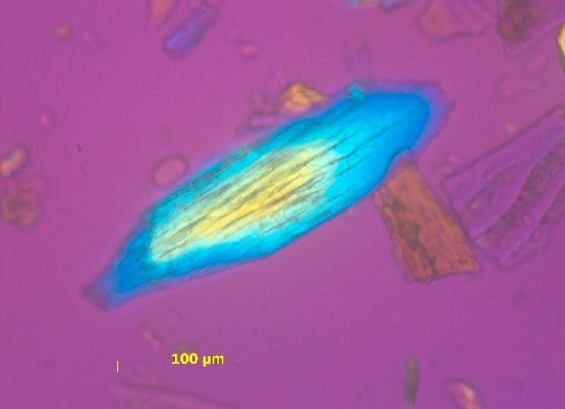 Lasermikroskop-Aufnahme von Fischknochen bei 200facher Vergrößerung plus Pol- und Rotfilter